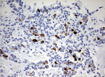 KRT20 Antibody in Immunohistochemistry (Paraffin) (IHC (P))