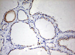 KRT20 Antibody in Immunohistochemistry (Paraffin) (IHC (P))