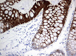 KRT20 Antibody in Immunohistochemistry (Paraffin) (IHC (P))