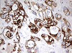KRT20 Antibody in Immunohistochemistry (Paraffin) (IHC (P))