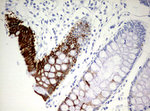 KRT20 Antibody in Immunohistochemistry (Paraffin) (IHC (P))