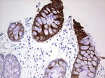 KRT20 Antibody in Immunohistochemistry (Paraffin) (IHC (P))