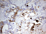 KRT20 Antibody in Immunohistochemistry (Paraffin) (IHC (P))