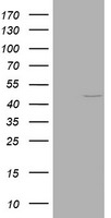 KRT20 Antibody in Western Blot (WB)