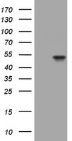 KRT20 Antibody in Western Blot (WB)