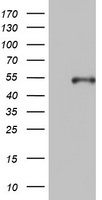 KRT20 Antibody in Western Blot (WB)