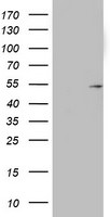 KRT20 Antibody in Western Blot (WB)