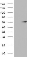 KRT20 Antibody in Western Blot (WB)