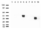 KRT20 Antibody in Western Blot (WB)
