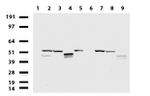 KRT20 Antibody in Western Blot (WB)