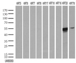 KRT20 Antibody in Western Blot (WB)