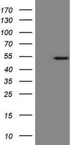 KRT23 Antibody in Western Blot (WB)