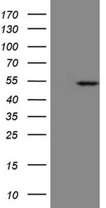 KRT23 Antibody in Western Blot (WB)
