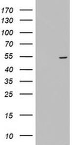 KRT24 Antibody in Western Blot (WB)