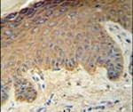 Cytokeratin 35 Antibody in Immunohistochemistry (IHC)