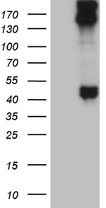 KRT35 Antibody in Western Blot (WB)