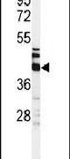 Cytokeratin 35 Antibody in Western Blot (WB)