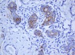KRT5 Antibody in Immunohistochemistry (Paraffin) (IHC (P))