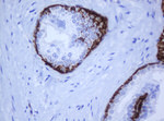 KRT5 Antibody in Immunohistochemistry (Paraffin) (IHC (P))