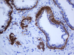 KRT5 Antibody in Immunohistochemistry (Paraffin) (IHC (P))