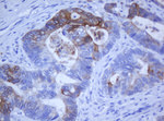 KRT5 Antibody in Immunohistochemistry (Paraffin) (IHC (P))