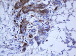 KRT5 Antibody in Immunohistochemistry (Paraffin) (IHC (P))