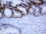 KRT5 Antibody in Immunohistochemistry (Paraffin) (IHC (P))