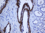 KRT5 Antibody in Immunohistochemistry (Paraffin) (IHC (P))