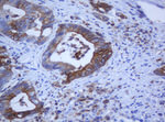 KRT5 Antibody in Immunohistochemistry (Paraffin) (IHC (P))