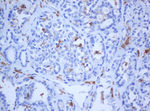 KRT5 Antibody in Immunohistochemistry (Paraffin) (IHC (P))