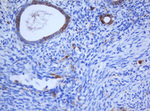 KRT5 Antibody in Immunohistochemistry (Paraffin) (IHC (P))