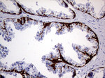KRT5 Antibody in Immunohistochemistry (Paraffin) (IHC (P))