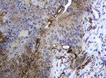 KRT5 Antibody in Immunohistochemistry (Paraffin) (IHC (P))