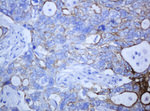KRT5 Antibody in Immunohistochemistry (Paraffin) (IHC (P))