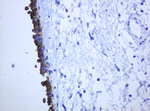 KRT5 Antibody in Immunohistochemistry (Paraffin) (IHC (P))