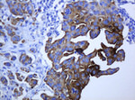 KRT5 Antibody in Immunohistochemistry (Paraffin) (IHC (P))