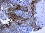 KRT5 Antibody in Immunohistochemistry (Paraffin) (IHC (P))