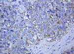 KRT5 Antibody in Immunohistochemistry (Paraffin) (IHC (P))