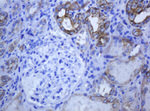 KRT5 Antibody in Immunohistochemistry (Paraffin) (IHC (P))