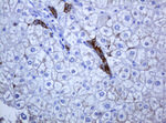 KRT5 Antibody in Immunohistochemistry (Paraffin) (IHC (P))