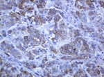 KRT5 Antibody in Immunohistochemistry (Paraffin) (IHC (P))