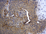 KRT5 Antibody in Immunohistochemistry (Paraffin) (IHC (P))