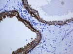 KRT5 Antibody in Immunohistochemistry (Paraffin) (IHC (P))