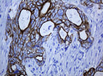 KRT5 Antibody in Immunohistochemistry (Paraffin) (IHC (P))