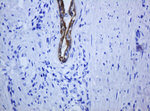 KRT5 Antibody in Immunohistochemistry (Paraffin) (IHC (P))