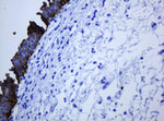 KRT5 Antibody in Immunohistochemistry (Paraffin) (IHC (P))