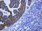 KRT5 Antibody in Immunohistochemistry (Paraffin) (IHC (P))
