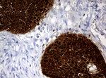 KRT5 Antibody in Immunohistochemistry (Paraffin) (IHC (P))