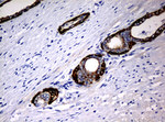 KRT5 Antibody in Immunohistochemistry (Paraffin) (IHC (P))