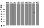 KRT5 Antibody in Western Blot (WB)